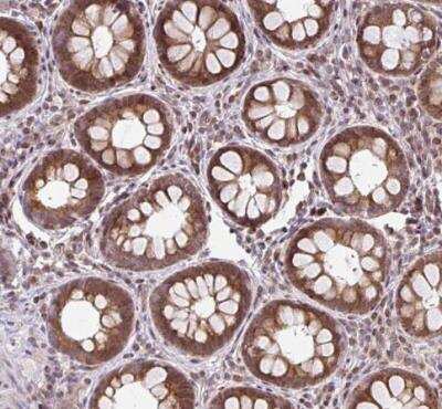 Immunohistochemistry-Paraffin: FIGNL1 Antibody [NBP2-47456]