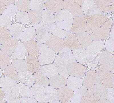 Immunohistochemistry-Paraffin: FIGNL1 Antibody [NBP2-47456]