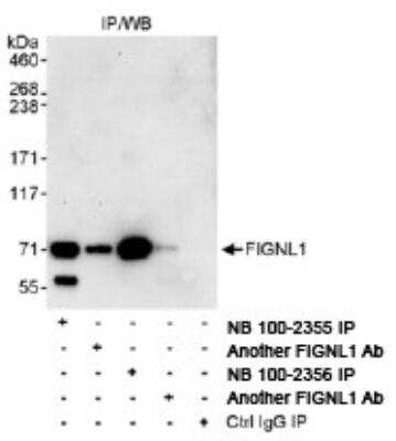 Immunoprecipitation: FIGNL1 Antibody [NB100-2356]