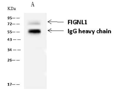 Immunoprecipitation: FIGNL1 Antibody [NBP2-97167]