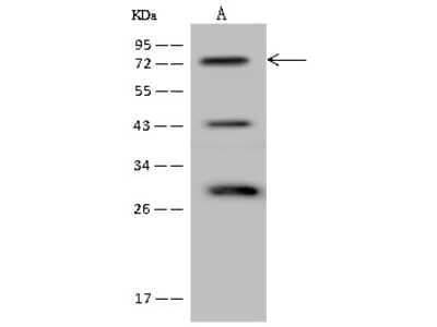 Western Blot: FIGNL1 Antibody [NBP2-97167]