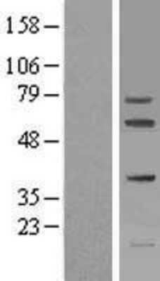 Western Blot: FIGNL1 Overexpression Lysate [NBL1-10724]