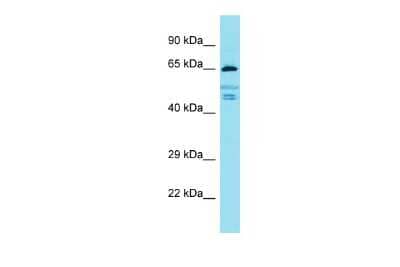 Western Blot: FIGNL2 Antibody [NBP3-09720]