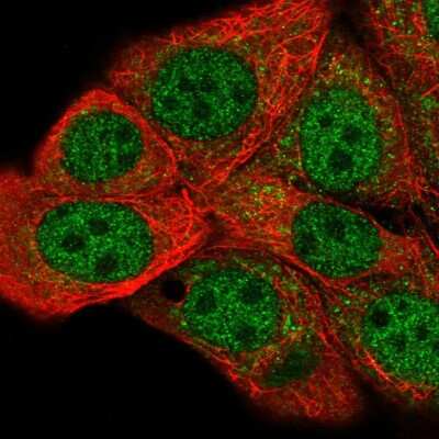 Immunocytochemistry/ Immunofluorescence: FIH-1/HIF-1AN Antibody [NBP2-58365]