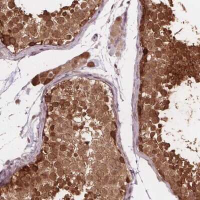 Immunohistochemistry-Paraffin: FIH-1/HIF-1AN Antibody [NBP2-54749]