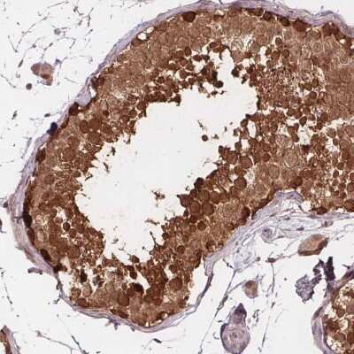 Immunohistochemistry-Paraffin: FIH-1/HIF-1AN Antibody [NBP2-54749]