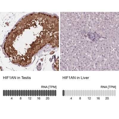 Immunohistochemistry-Paraffin: FIH-1/HIF-1AN Antibody [NBP2-54749]