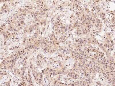 Immunohistochemistry-Paraffin: FIH-1/HIF-1AN Antibody [NBP2-99356]