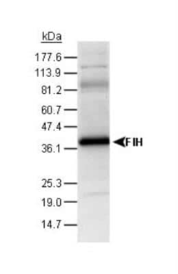 Western Blot: FIH-1/HIF-1AN Antibody [NB100-428]