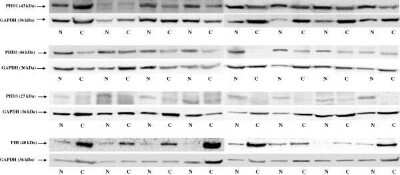 Western Blot: FIH-1/HIF-1AN Antibody [NB100-428]