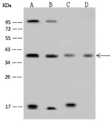 Western Blot: FIH-1/HIF-1AN Antibody [NBP2-99356]