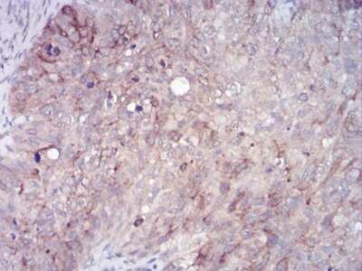 Immunohistochemistry-Paraffin: FIP1/RCP Antibody (1A12B9D8) - BSA Free [NBP2-52546]