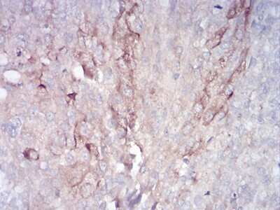Immunohistochemistry-Paraffin: FIP1/RCP Antibody (1A12B9D8) - BSA Free [NBP2-52546]