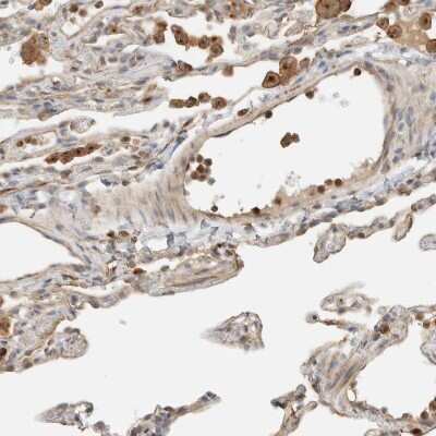 Immunohistochemistry-Paraffin: FIP1/RCP Antibody [NBP1-83598]