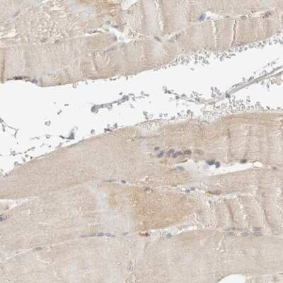 Immunohistochemistry-Paraffin: FIP1/RCP Antibody [NBP1-83598]