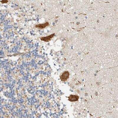 Immunohistochemistry-Paraffin: FIP1/RCP Antibody [NBP1-83599]