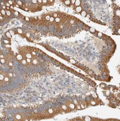 Immunohistochemistry-Paraffin: FIP1/RCP Antibody [NBP1-83599]