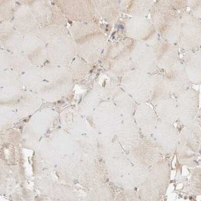 Immunohistochemistry-Paraffin: FIP1/RCP Antibody [NBP1-83599]