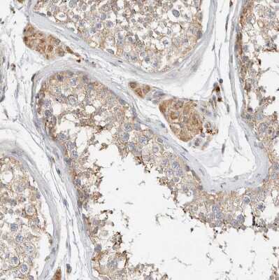 Immunohistochemistry-Paraffin: FIP1/RCP Antibody [NBP1-83599]