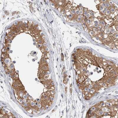 Immunohistochemistry-Paraffin: FIP1/RCP Antibody [NBP1-83600]