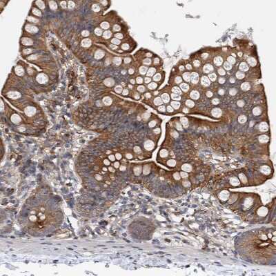 Immunohistochemistry-Paraffin: FIP1/RCP Antibody [NBP1-83600]