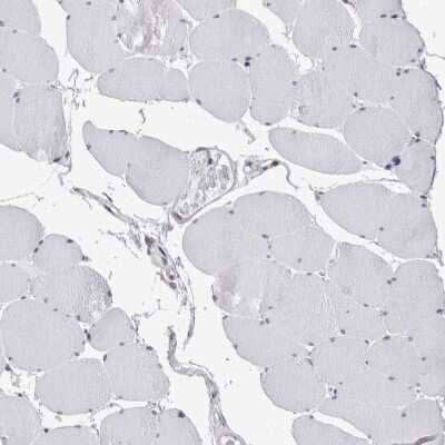 Immunohistochemistry-Paraffin: FIP1/RCP Antibody [NBP1-83600]
