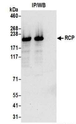 Immunoprecipitation: FIP1/RCP Antibody [NBP2-37698]
