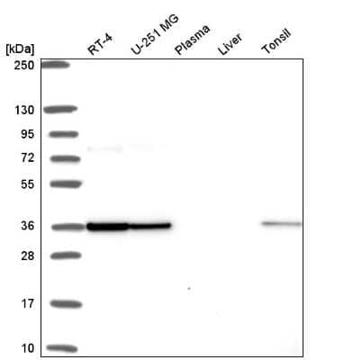 Western Blot: FIP1L1 Antibody [NBP2-55078]