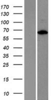 Western Blot: FIP1L1 Overexpression Lysate [NBP2-06165]