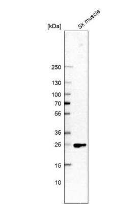 Western Blot: FITM1 Antibody [NBP1-84679]