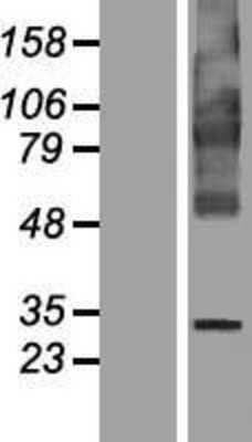 Western Blot: FITM1 Overexpression Lysate [NBP2-04565]