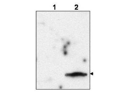Western Blot: FIV Matrix protein p15 Antibody [NBP3-11648]