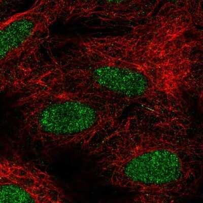 Immunocytochemistry/ Immunofluorescence: FIZ1 Antibody [NBP2-55994]