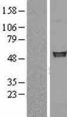 Western Blot: FIZ1 Overexpression Lysate [NBL1-10728]