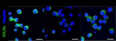 Immunocytochemistry/ Immunofluorescence: FIZZ1/RELM alpha Antibody - BSA Free [NBP2-29355]