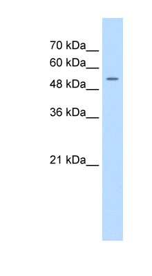 Western Blot: FJX1 Antibody [NBP1-59470]