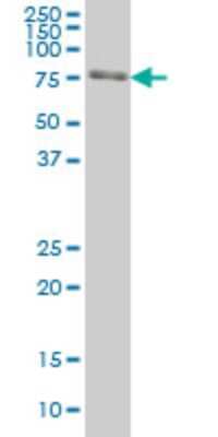 Western Blot: FKBP10 Antibody (1C6) [H00060681-M01]