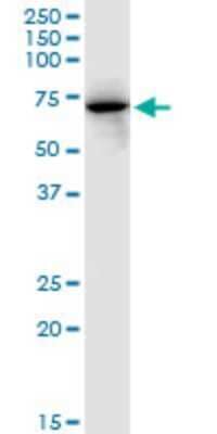 Western Blot: FKBP10 Antibody (2D4) [H00060681-M13]