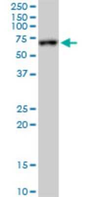 Western Blot: FKBP10 Antibody (3B5) [H00060681-M02]