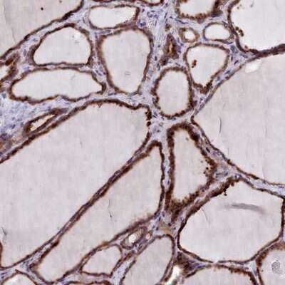 Immunohistochemistry-Paraffin: FKBP10 Antibody [NBP2-14016]