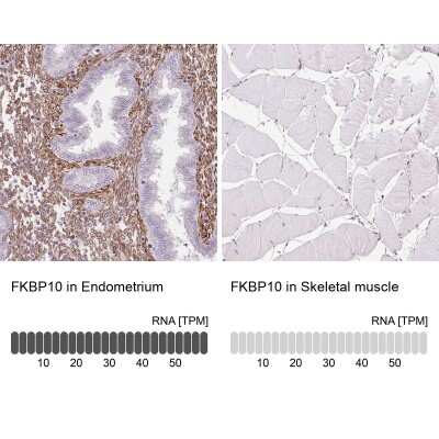 Immunohistochemistry-Paraffin: FKBP10 Antibody [NBP2-49242]