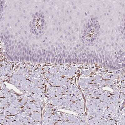 Immunohistochemistry-Paraffin: FKBP10 Antibody [NBP2-49242]