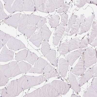 Immunohistochemistry-Paraffin: FKBP10 Antibody [NBP2-49242]