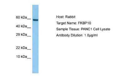 Western Blot: FKBP10 Antibody [NBP1-98560]