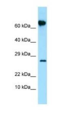 Western Blot: FKBP10 Antibody [NBP1-98561]