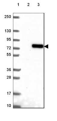Western Blot: FKBP10 Antibody [NBP2-49242]