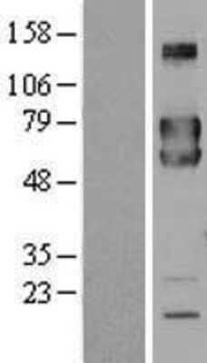 Western Blot: FKBP10 Overexpression Lysate [NBL1-10729]