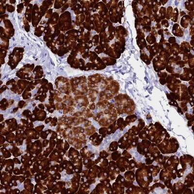 Immunohistochemistry-Paraffin: FKBP11 Antibody [NBP1-84678]