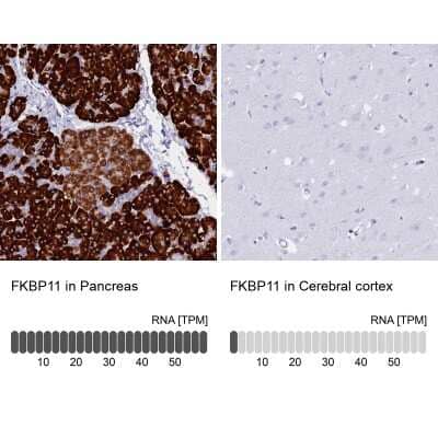 Immunohistochemistry-Paraffin: FKBP11 Antibody [NBP1-84678]