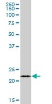 Western Blot: FKBP11 Antibody [H00051303-B01P]